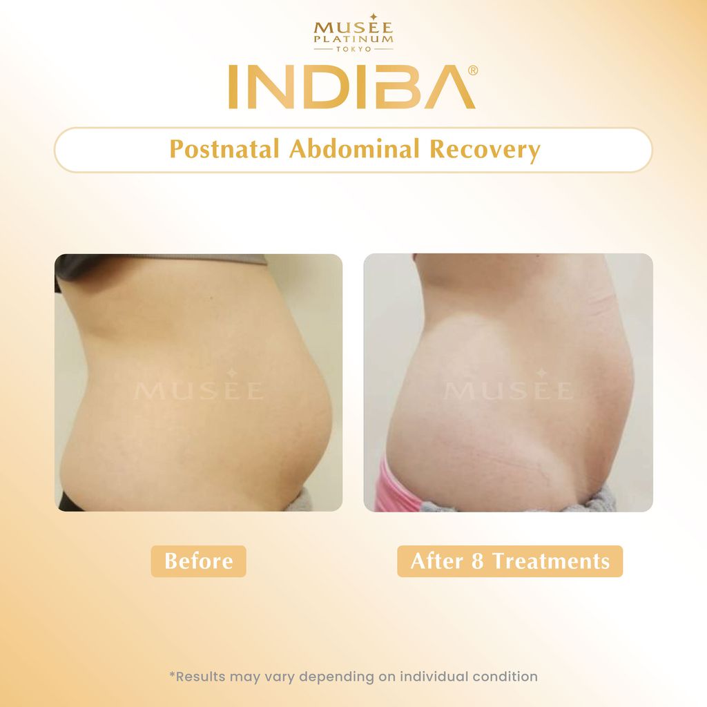 01. Testimonial_Indiba-02