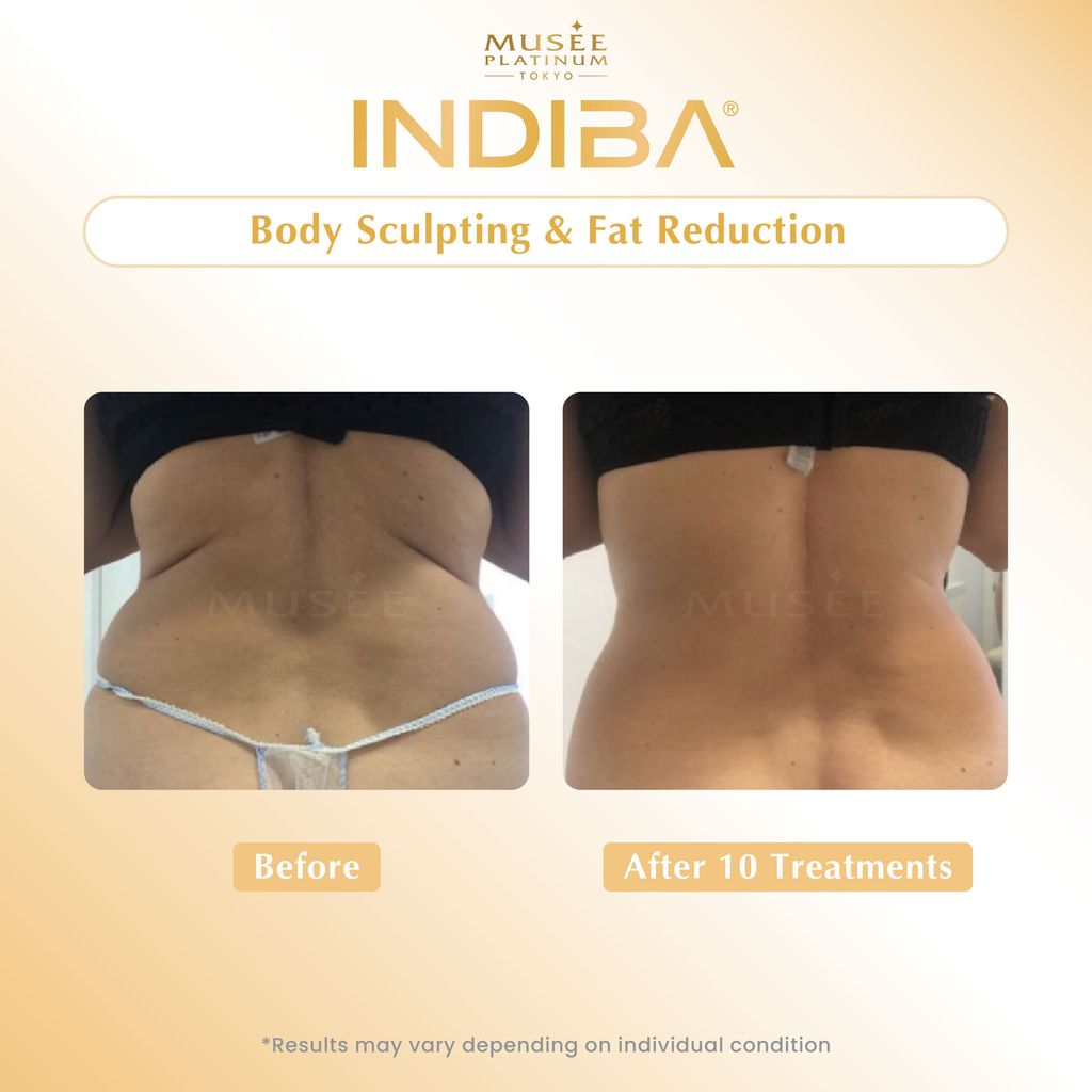 01. Testimonial_Indiba-03