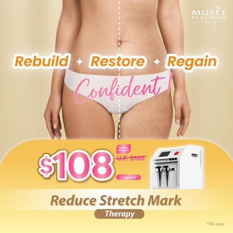 4. Static - Indiba Mummy Postpartum (Benefits)-01 2