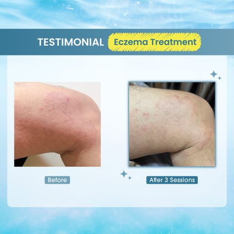NEW] DUO Hydrogen Skin Therapy - 1x Trial Sessions – Musee