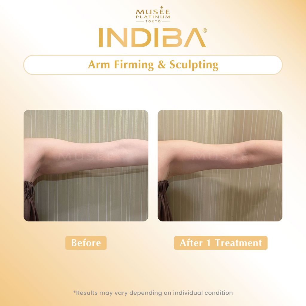 01. Testimonial_Indiba-04