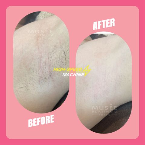 2. 59 Treatment Information-04