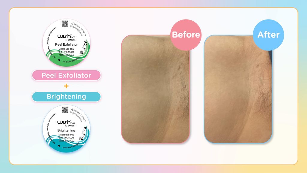 Wishpro Consultation Booklet-13