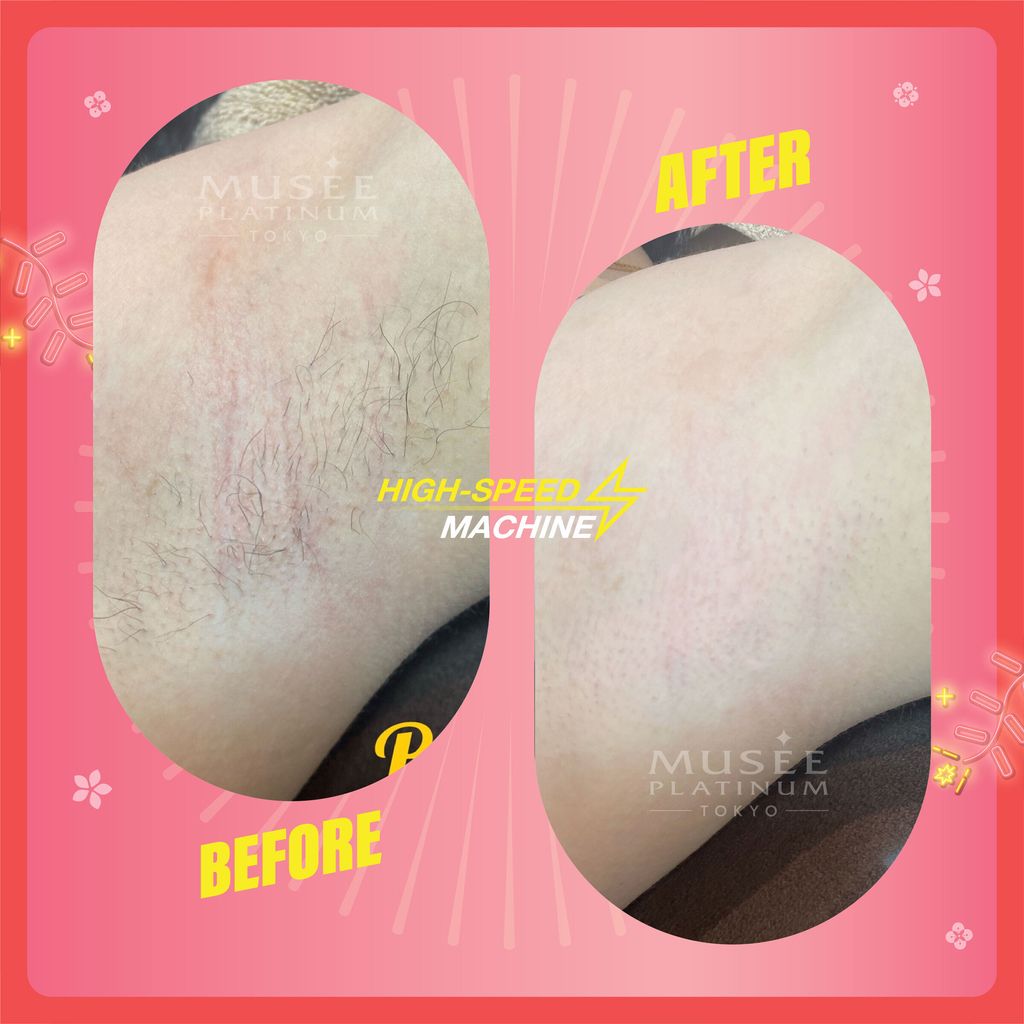 2. 18 Treatment Information-03