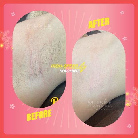 2. 18 Treatment Information-03