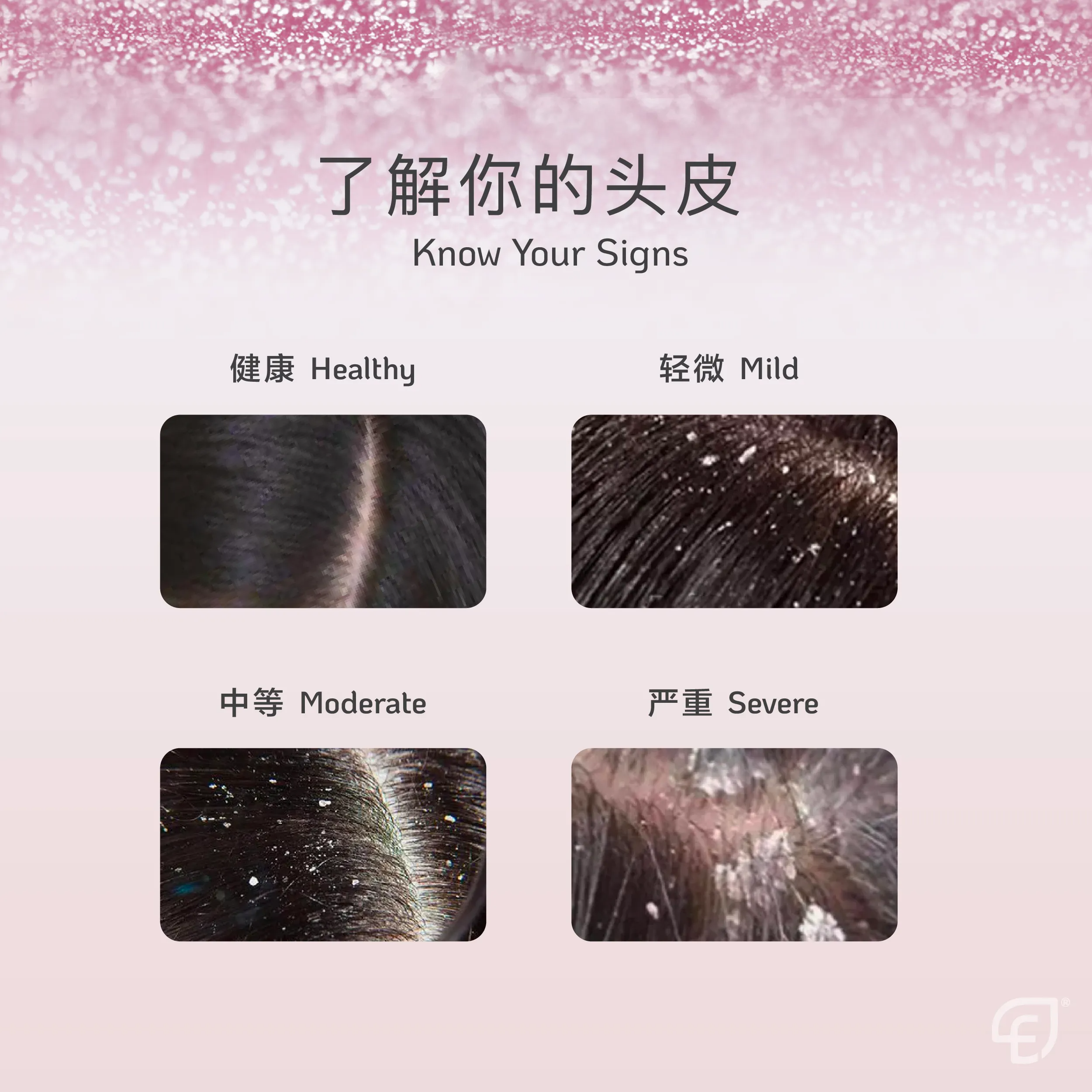 Scalp Shampoo POSM 2-02