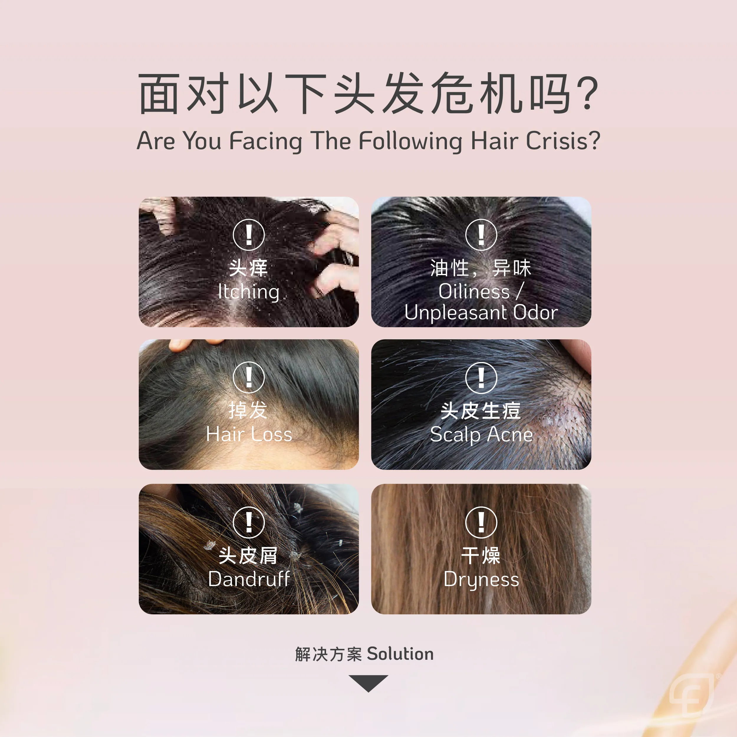 Scalp Shampoo POSM 2-03