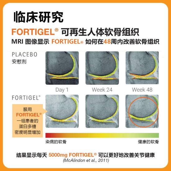 拥有16年德国临床实验 | Rejoint