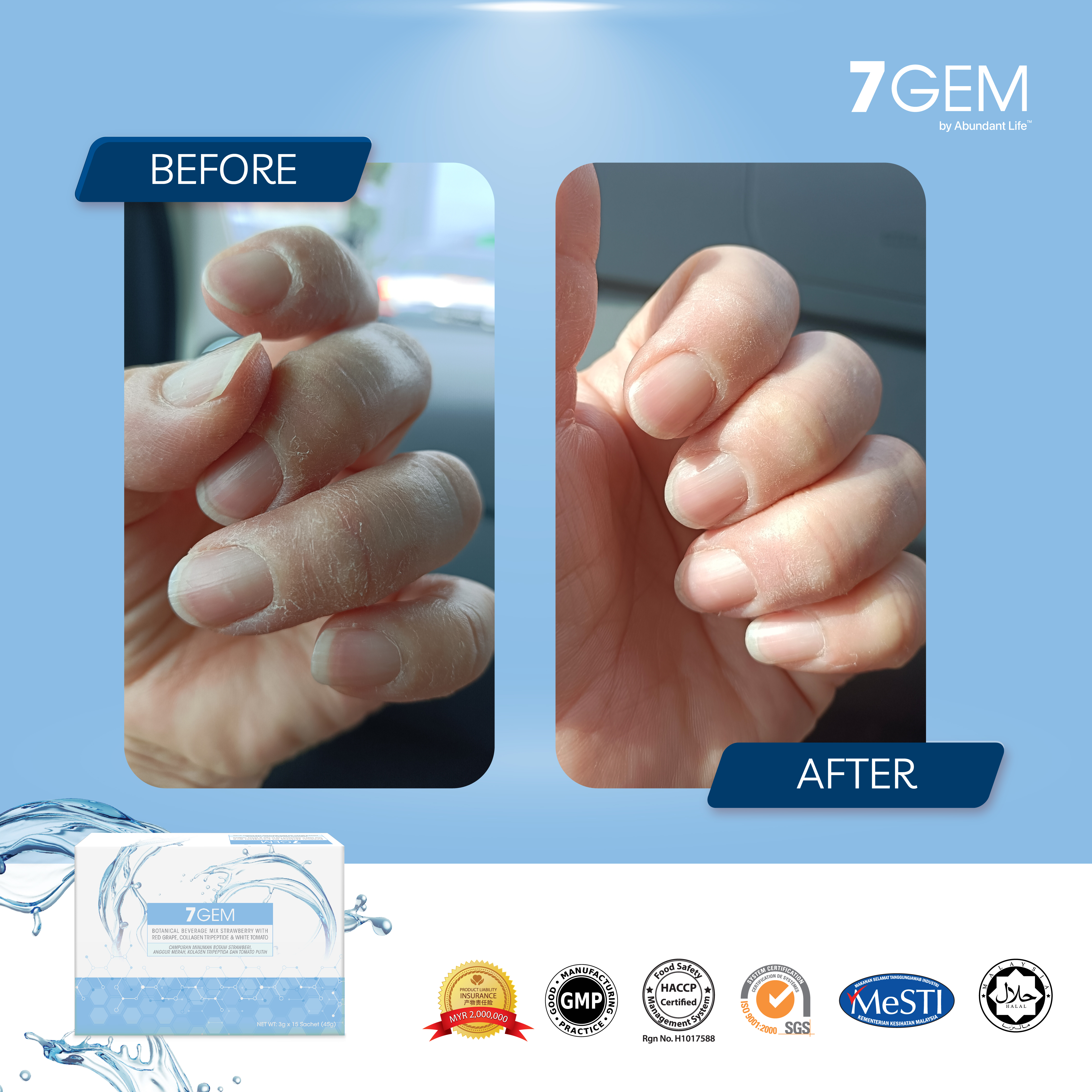 7GEM_Before After-08