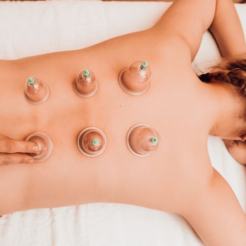 Cupping-Treatment