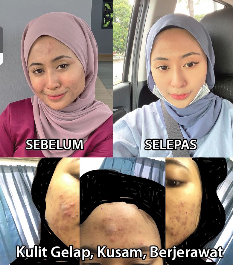 testimoni fellewhite