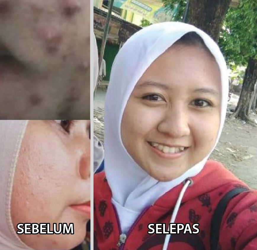 testimoni fellewhite 2