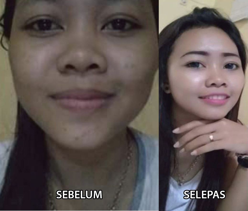 testimoni fellewhite 3