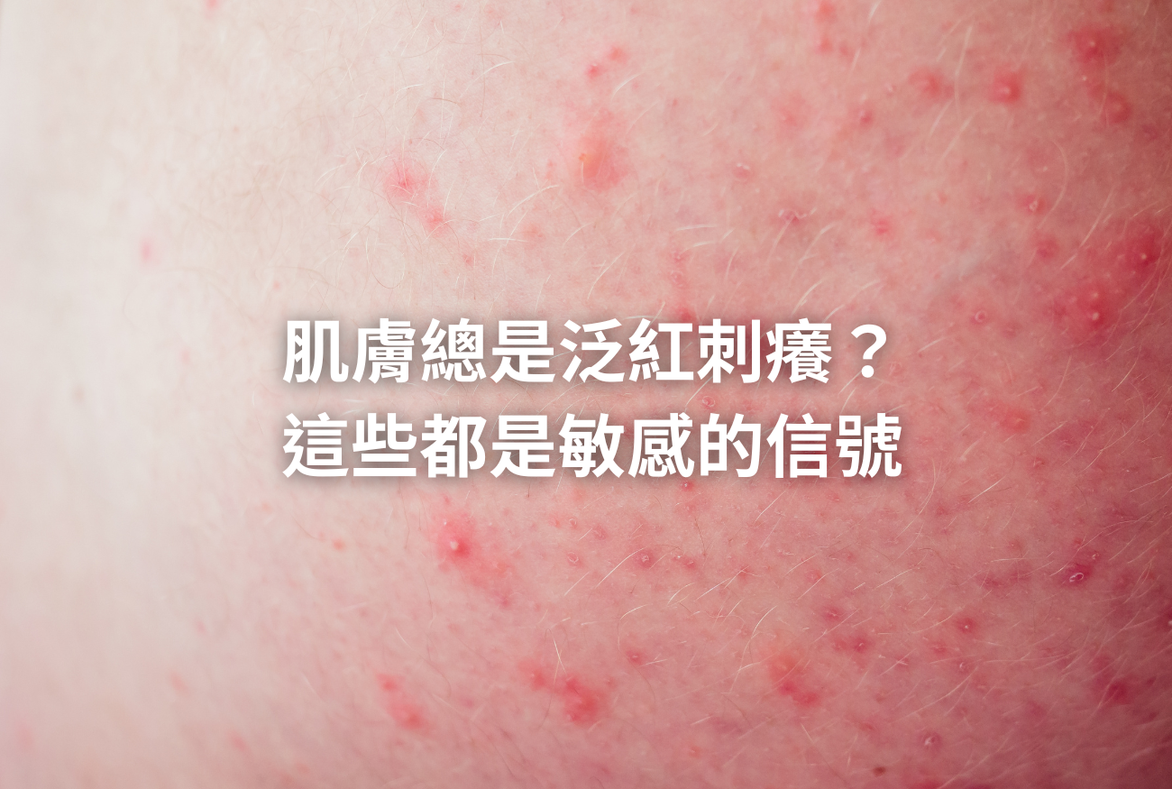 官網文章圖片 (32)