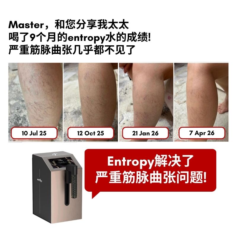 Entropy 解决严重筋脉曲张问题
