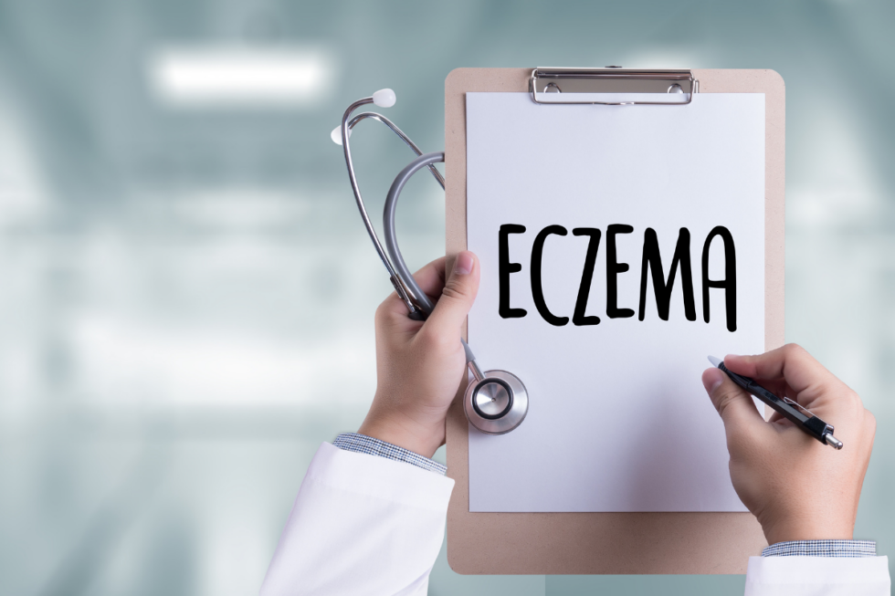 Kenali Eczema Dan 4 Penyebab Eczema
