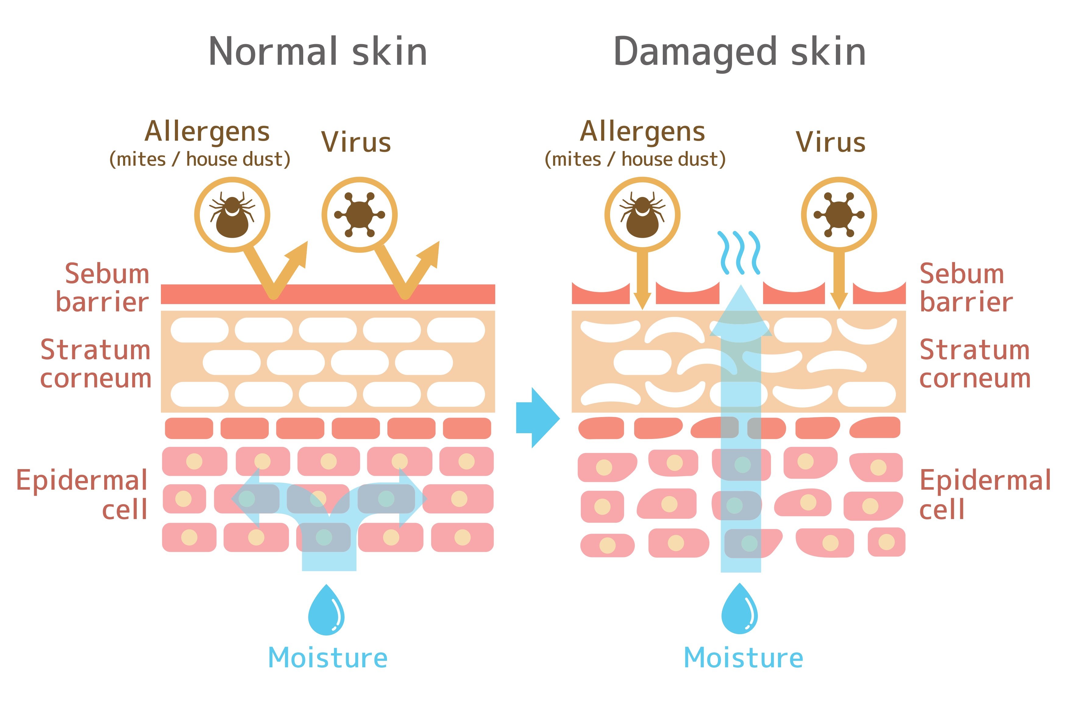 4 Tanda Skin Barrier Anda Rosak