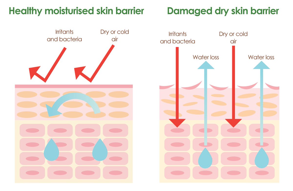 Skin Barrier Rosak?