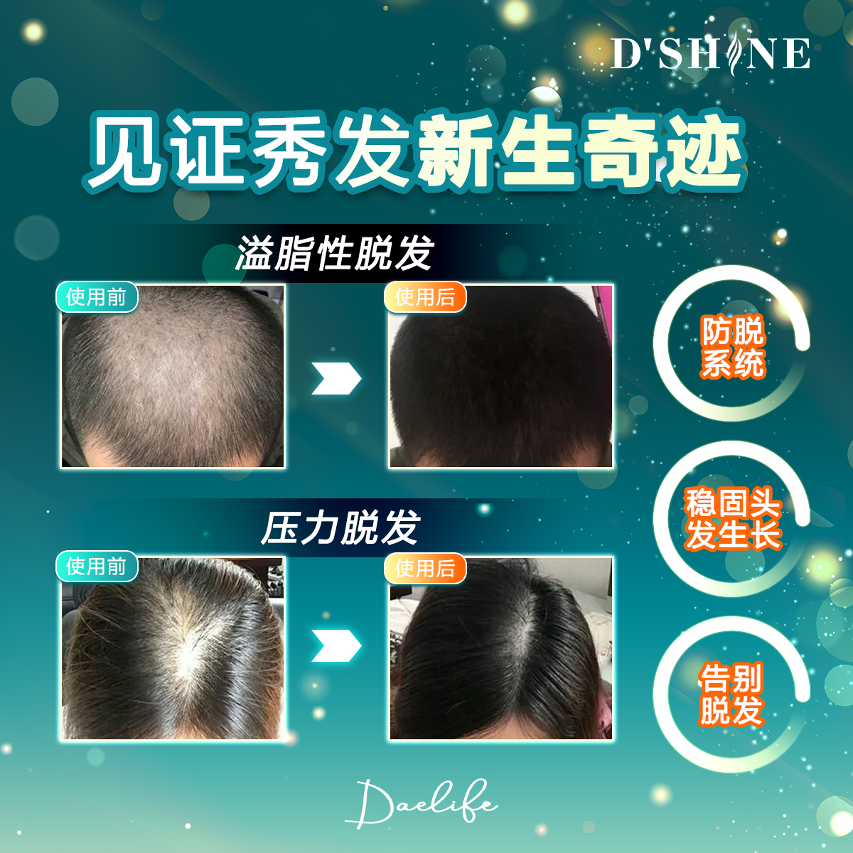 dshine poster 23