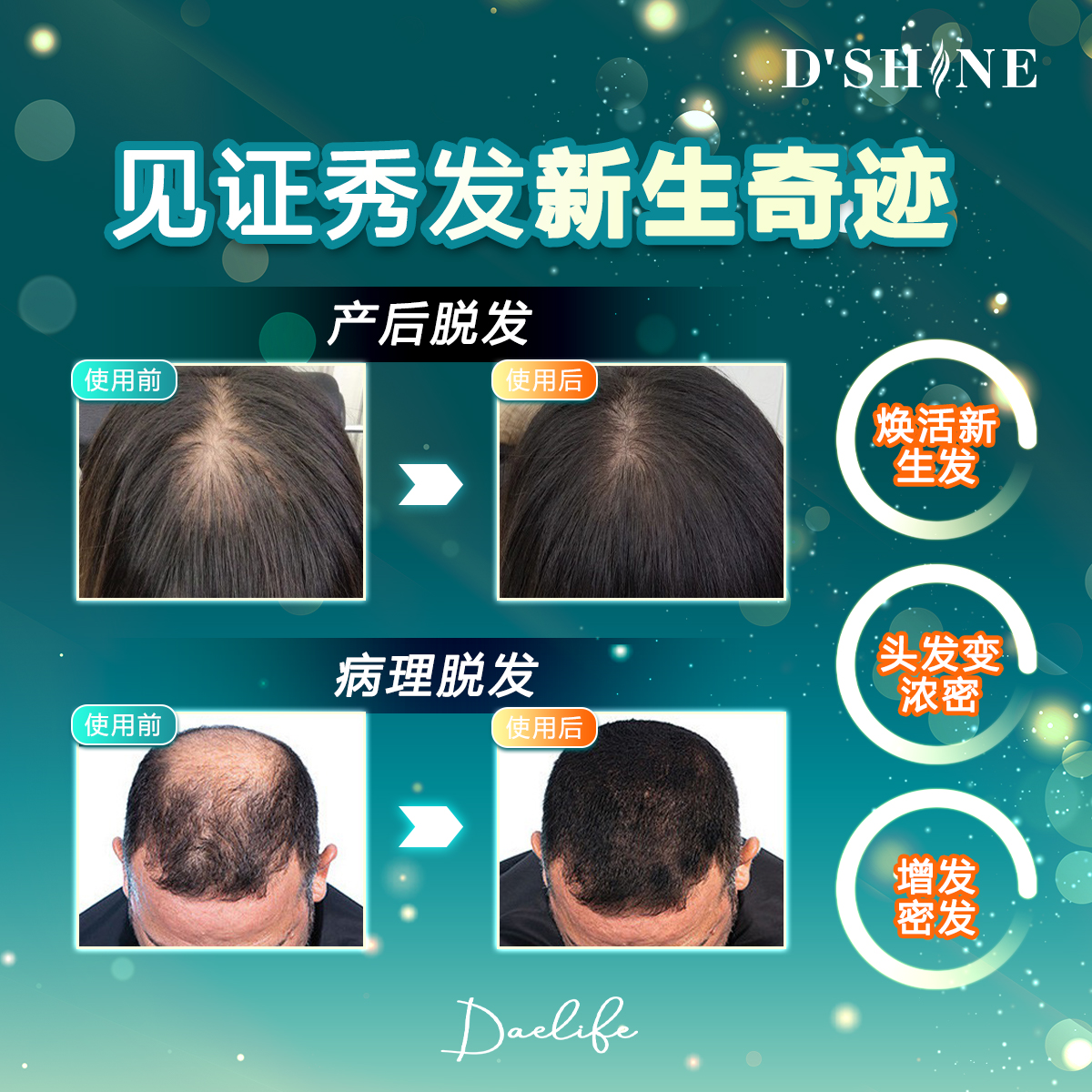dshine poster 24