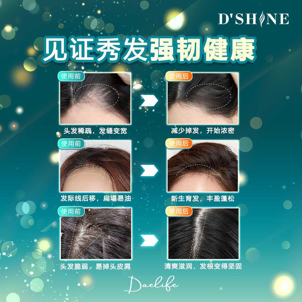dshine poster 22