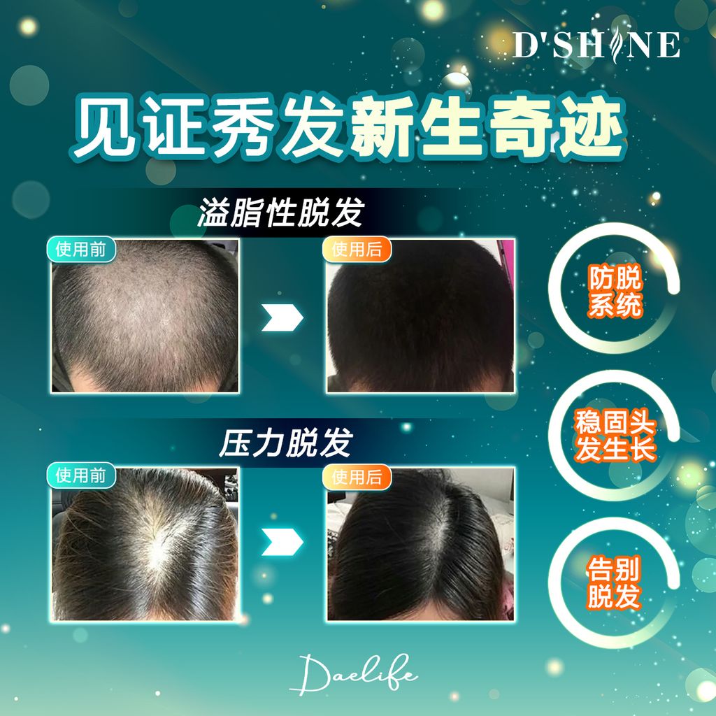 dshine poster 23