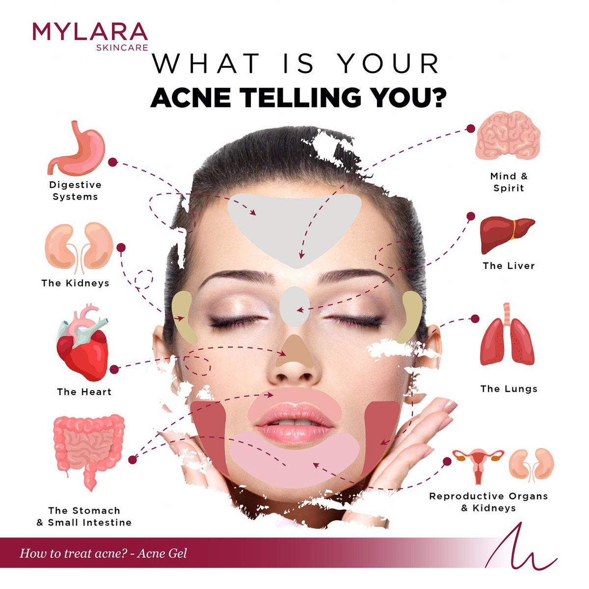 WHAT IS YOUR ACNE TELLING YOU?