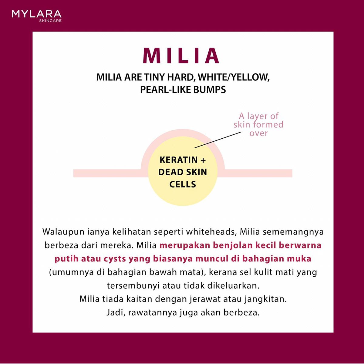 What is MILIA?