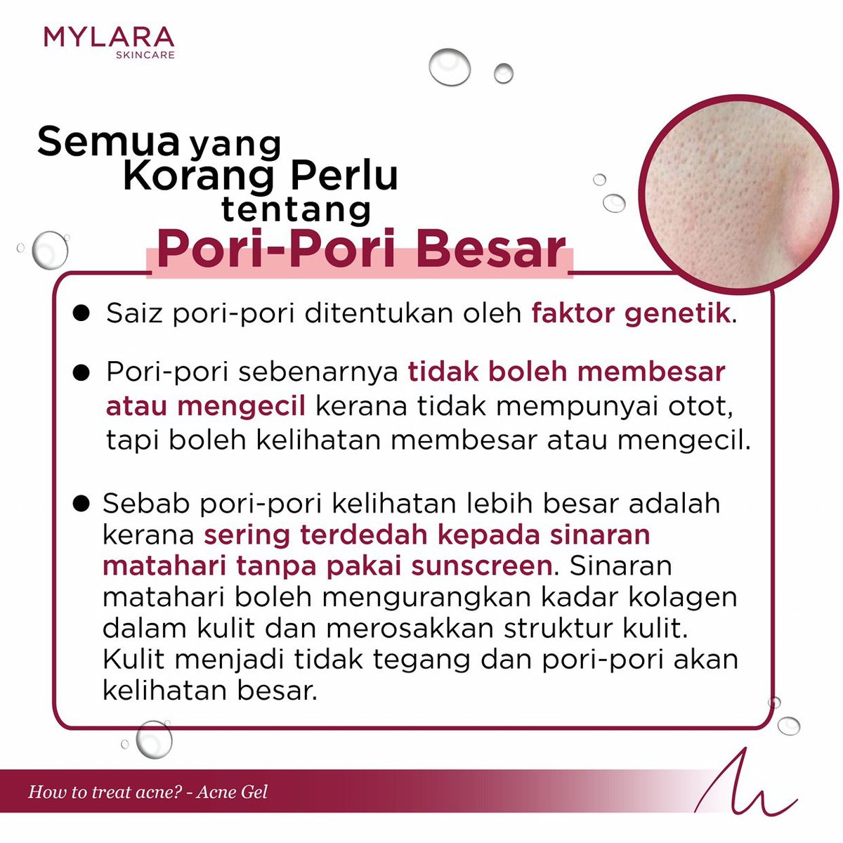 SEMUA YANG KORANG PERLU TENTANG PORI-PORI BESAR