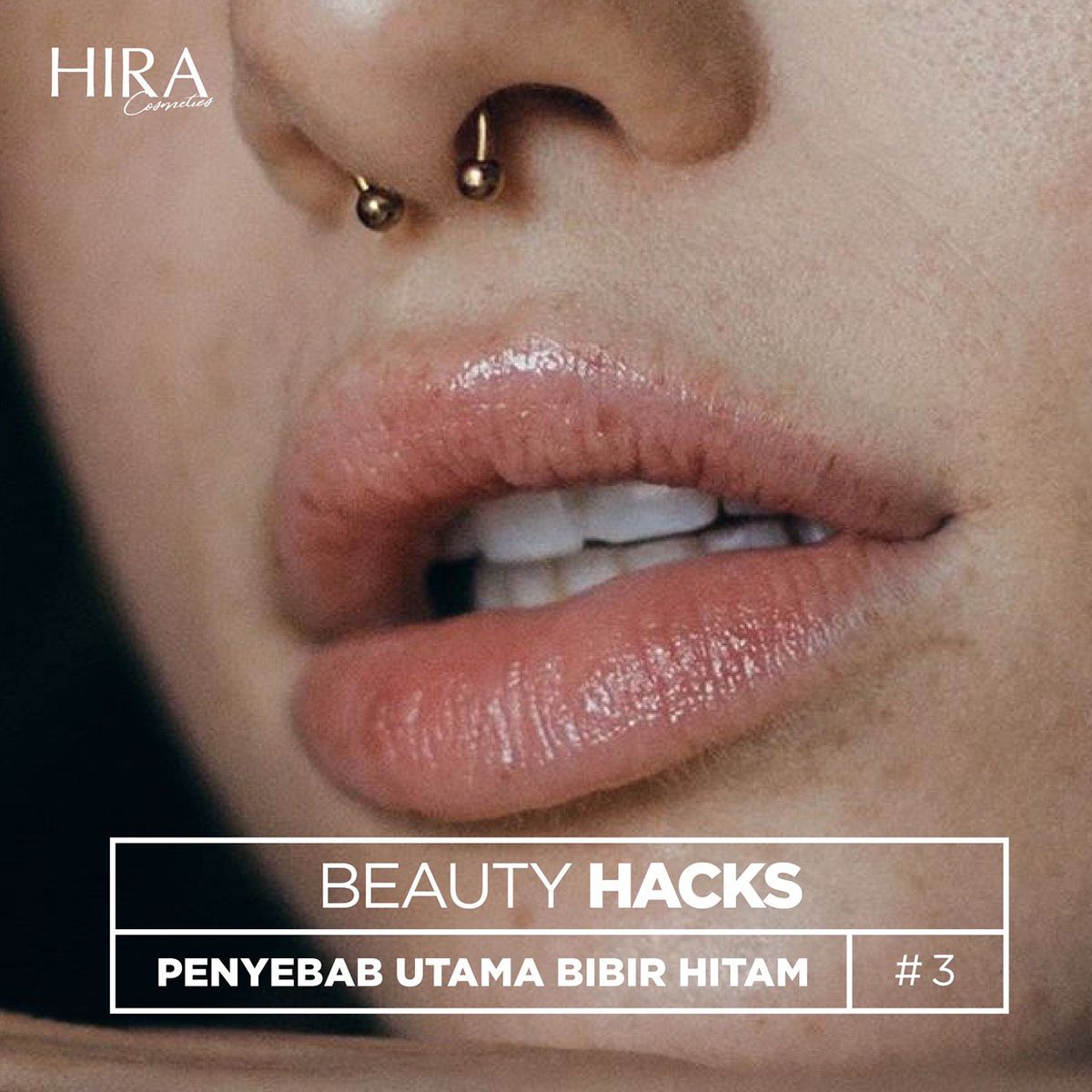 PENYEBAB UTAMA BIBIR HITAM