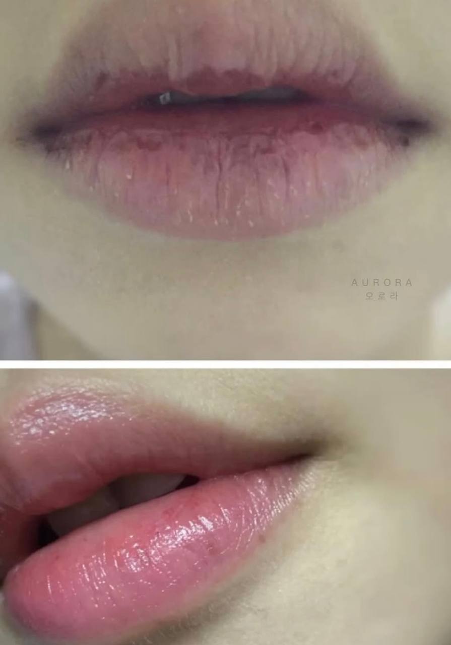 image_F21E58A8-E490-4DFB-9997-EF3D503936A0_1772626461