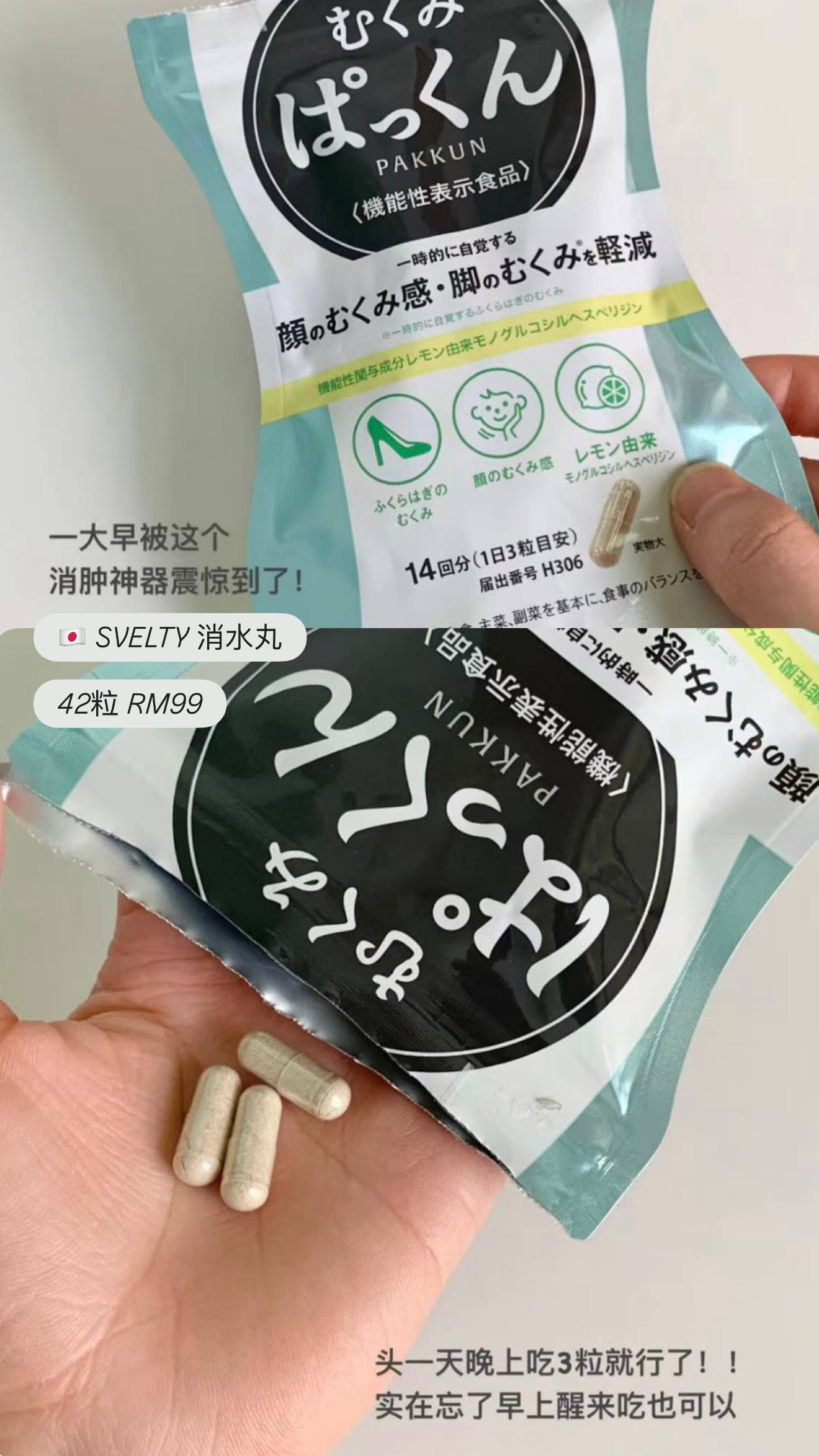 image_AE9AB29A-C197-4601-AF01-ADE408469B40_1772627670