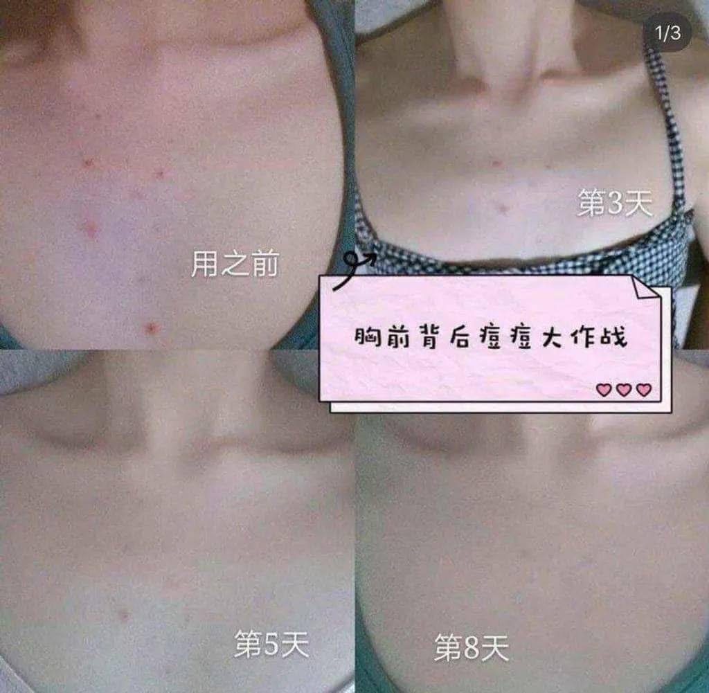 image_E664BC40-AD9D-464C-B5F9-17216B592926_1773206344