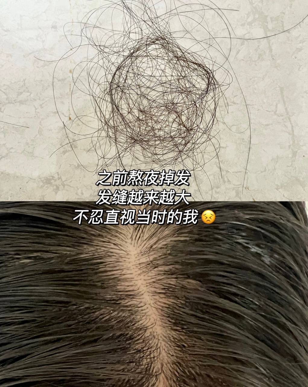 image_A45EC4E3-4143-424F-8F8E-3C03351B5147_1773328139