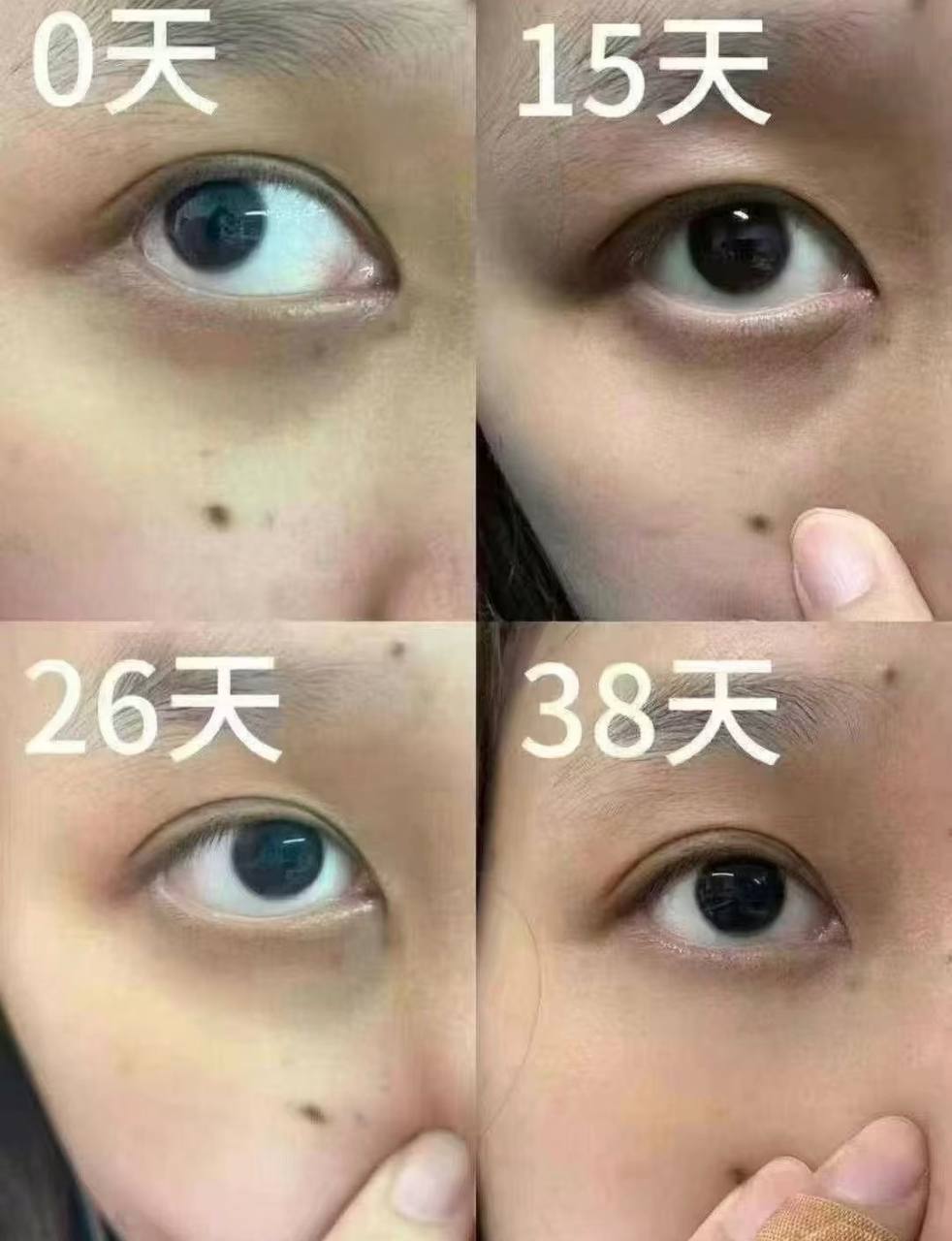 image_C15797C8-2625-4B5E-B470-0E42998C8651_1773338985