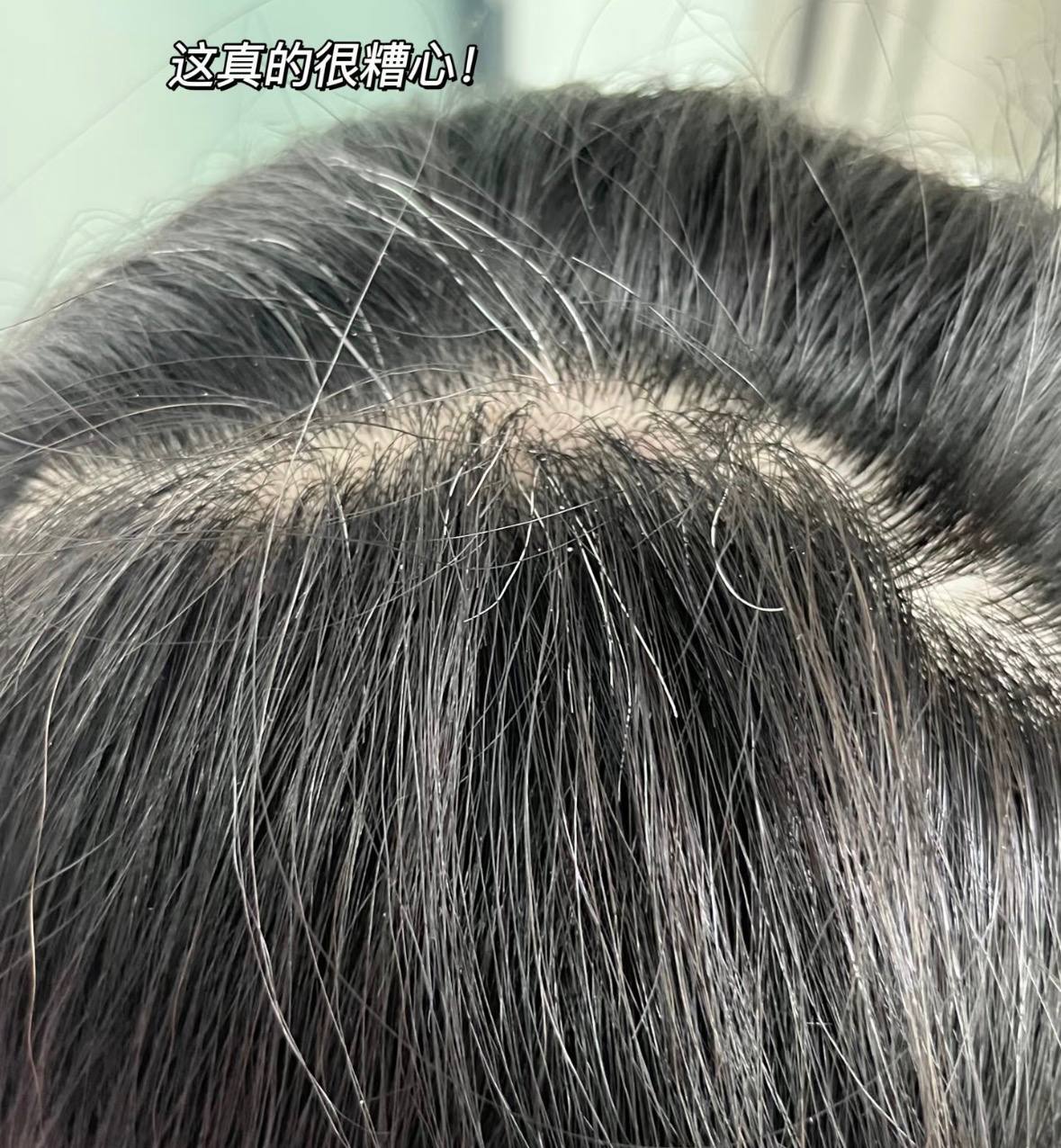 image_A65B43C9-F609-4E78-9CED-2097EEC90E85_1775657264