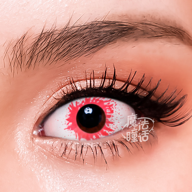bleeding-pupil-sclera-thumb-3