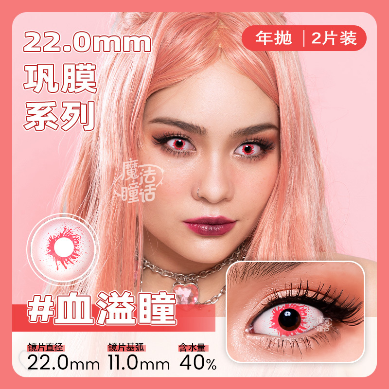 bleeding-pupil-sclera-thumb-1