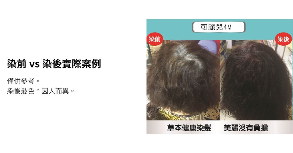 1433可麗兒植萃染髮劑．深棕紅4M 實際案例-編1