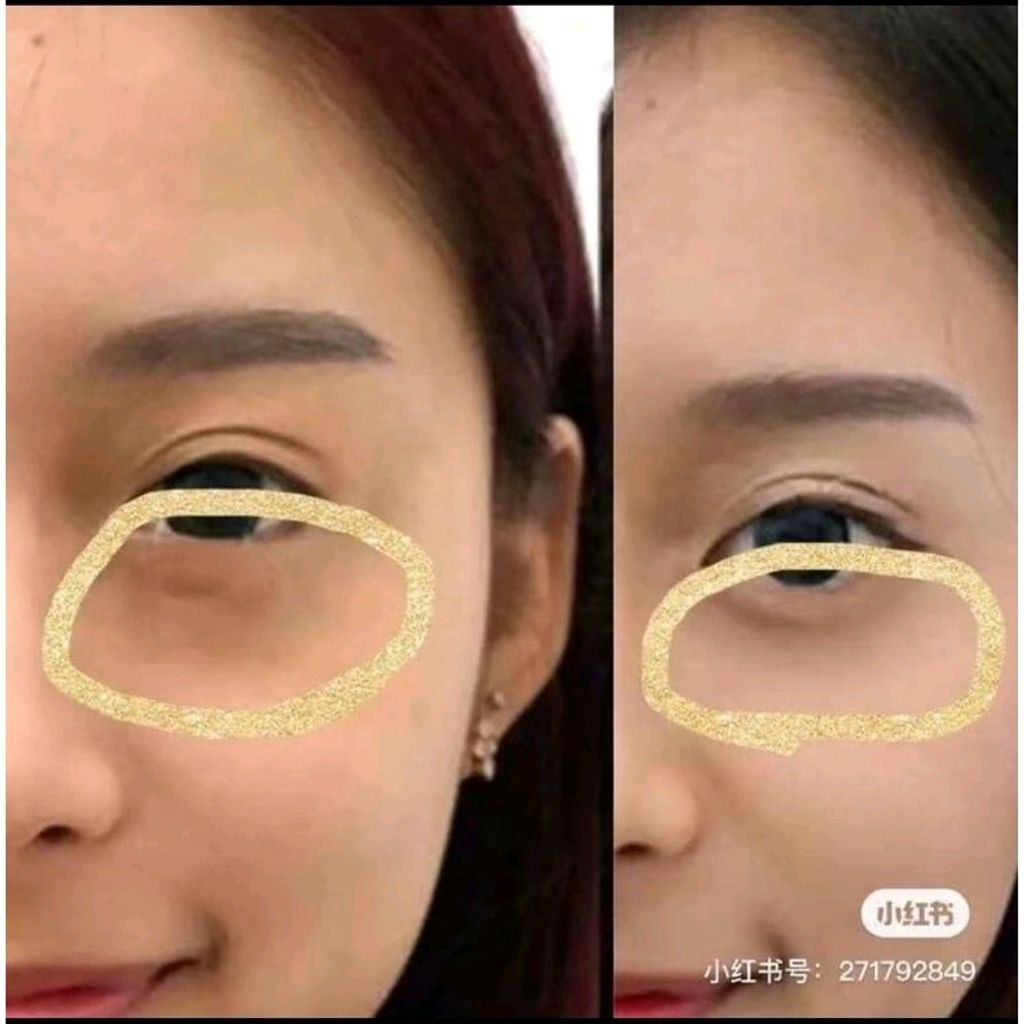 Shopee_b625d0b4bcfb0987e9a966efc4d85c2e