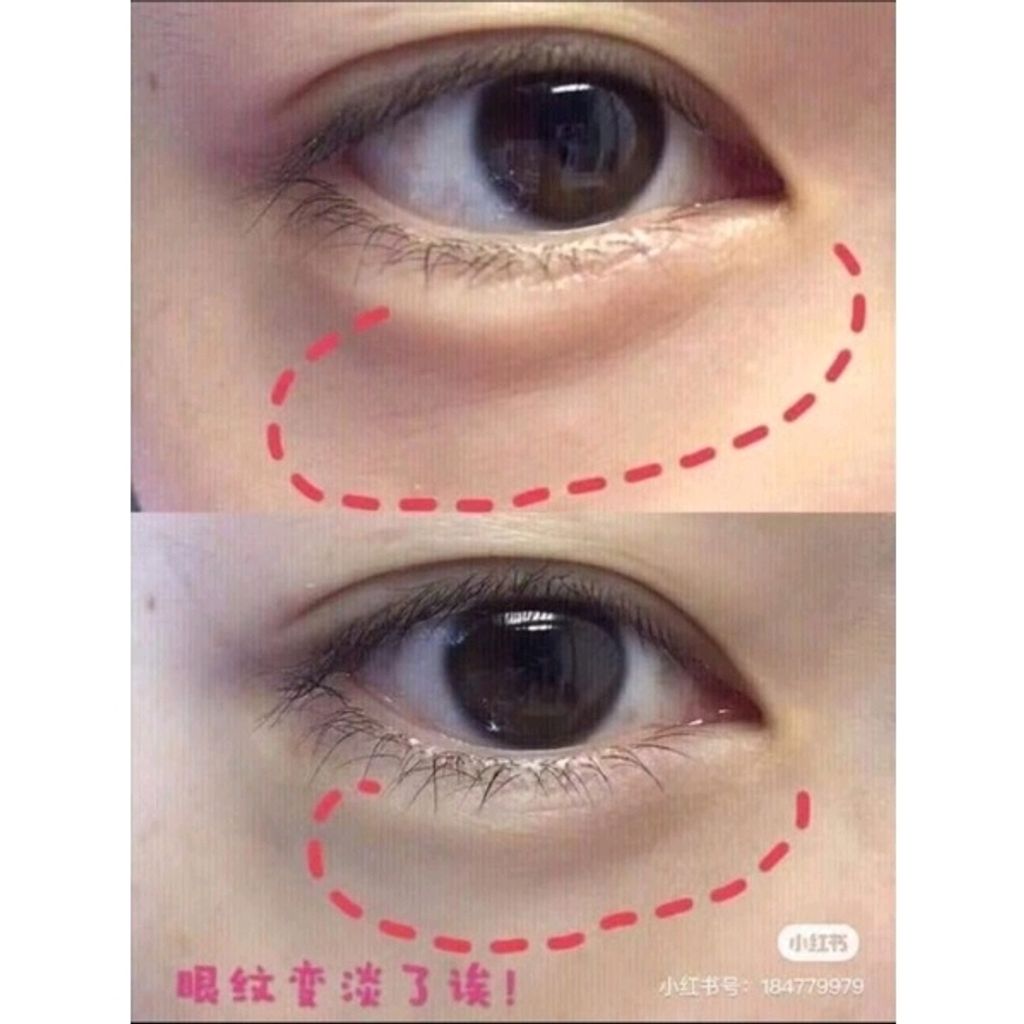 Shopee_6354f1533fbc992e478e57c51188b0f5