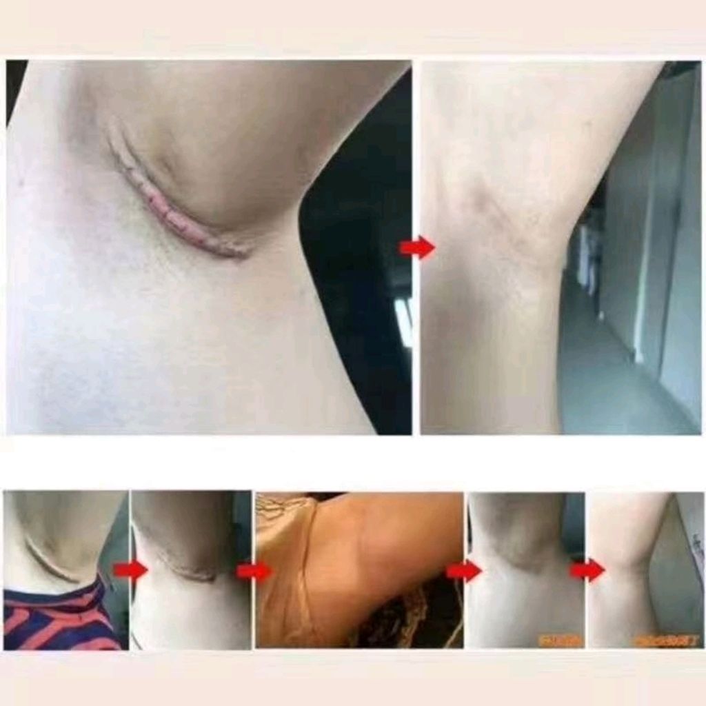 Shopee_1db759a4991ebc08abe6f72a279cb219