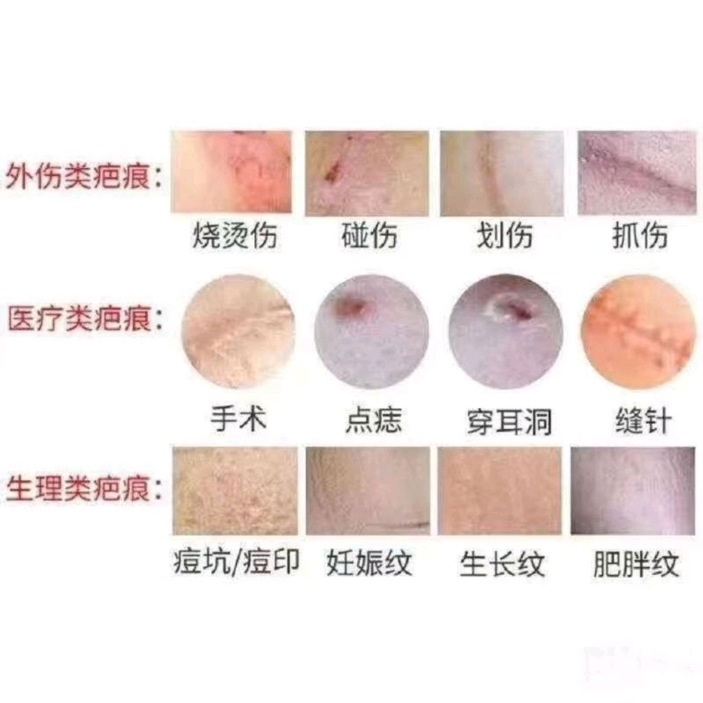 Shopee_a6ecac8418208cb04387fe8039b549fa