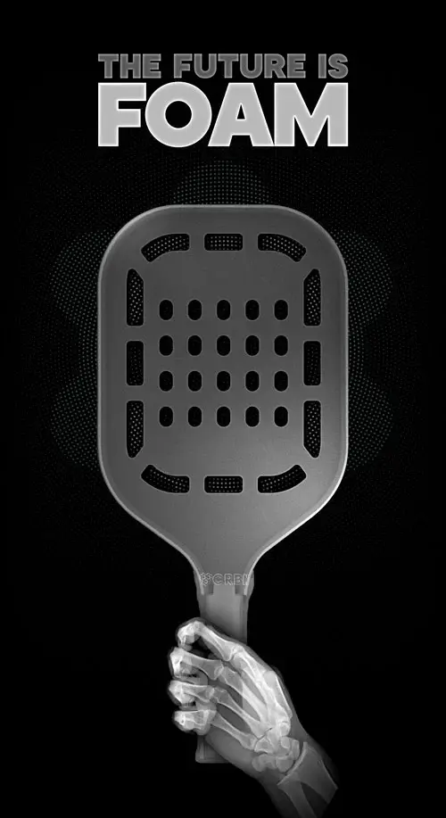CRBN-trufoam-genesis-x-ray-after