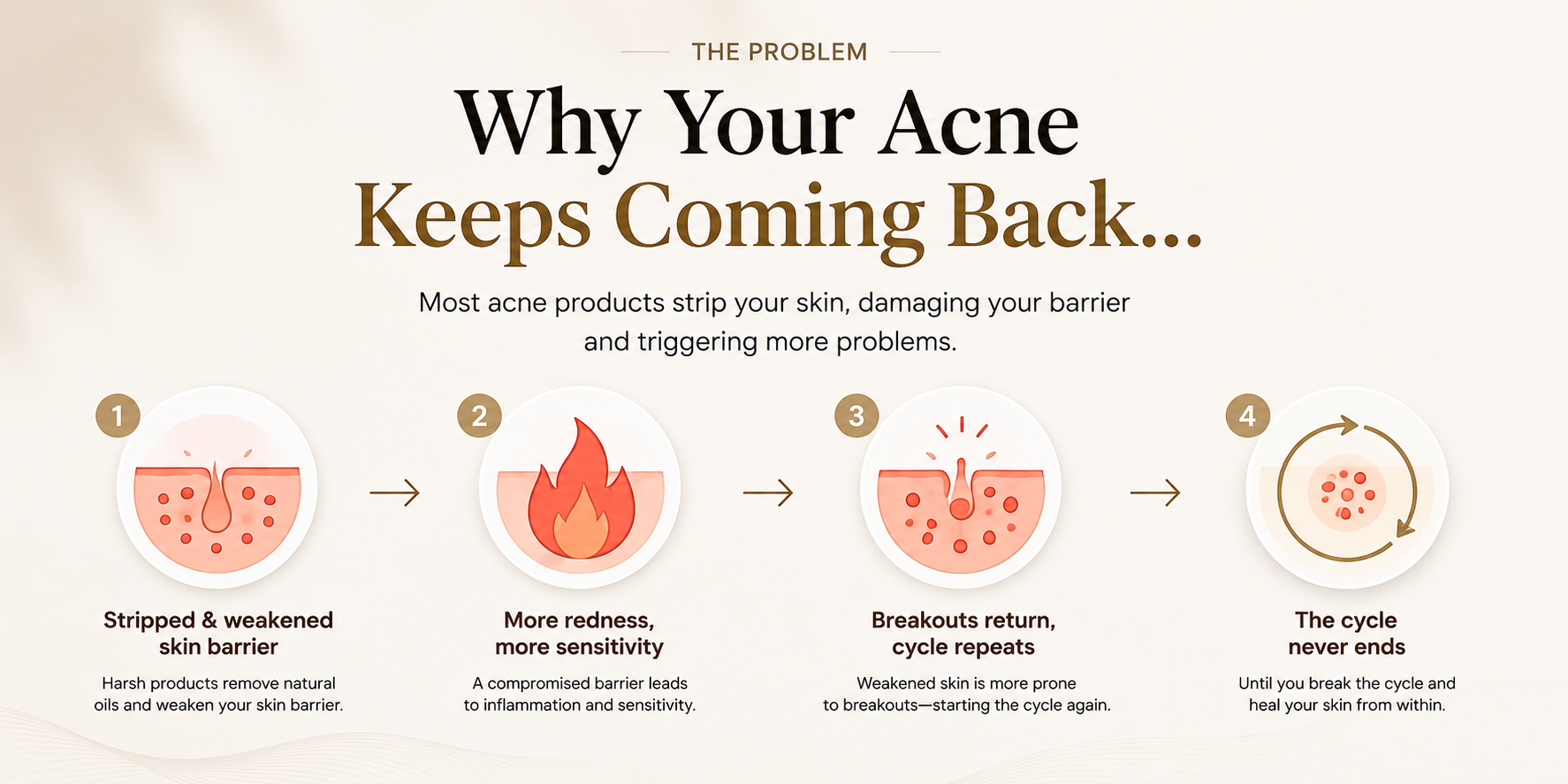 Acne Cycle 2