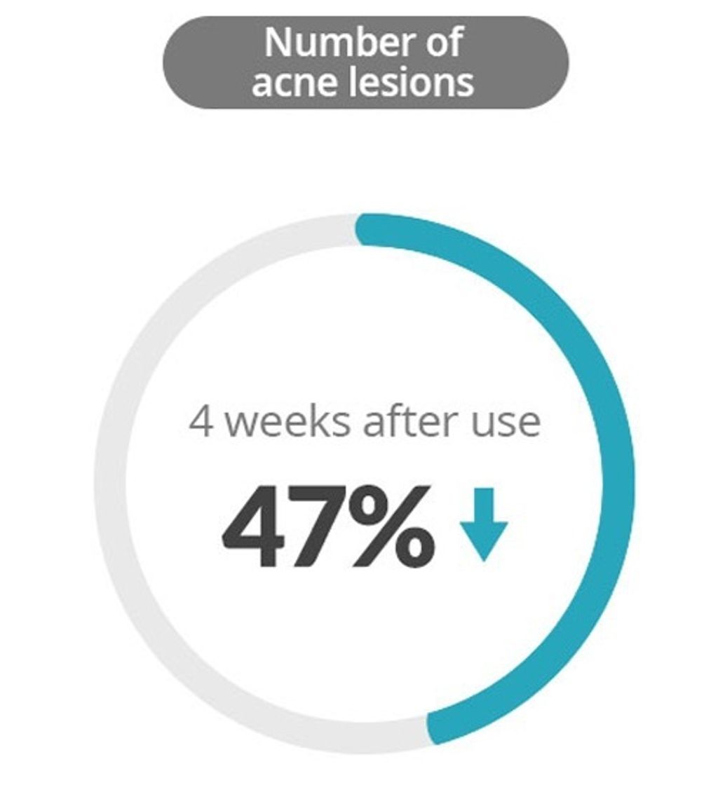 Buzz off acne lesions