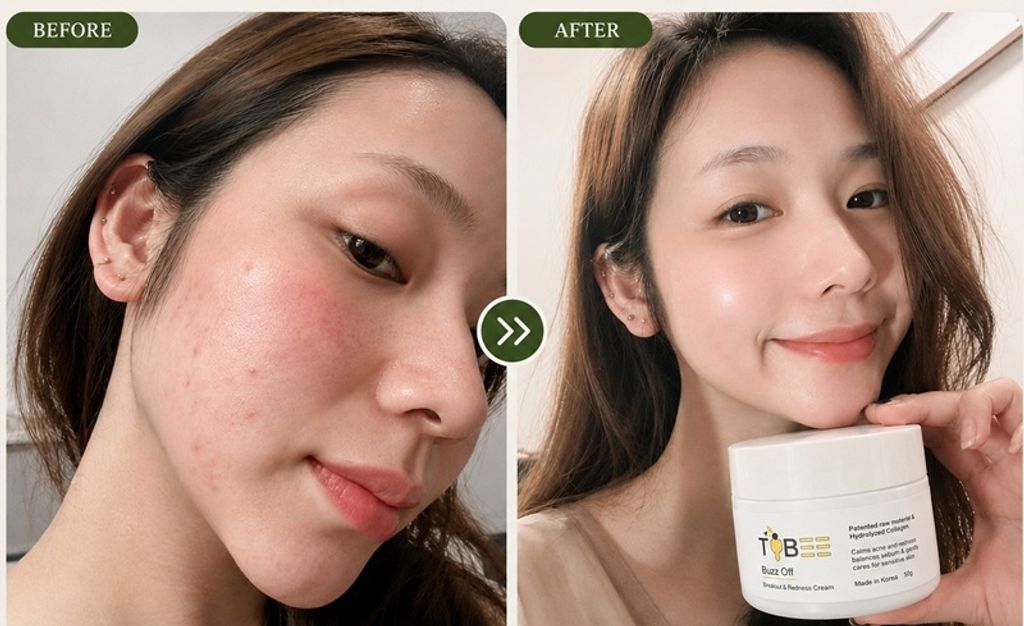 Young before after 2
