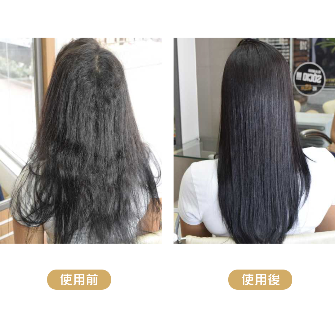 離子護-5