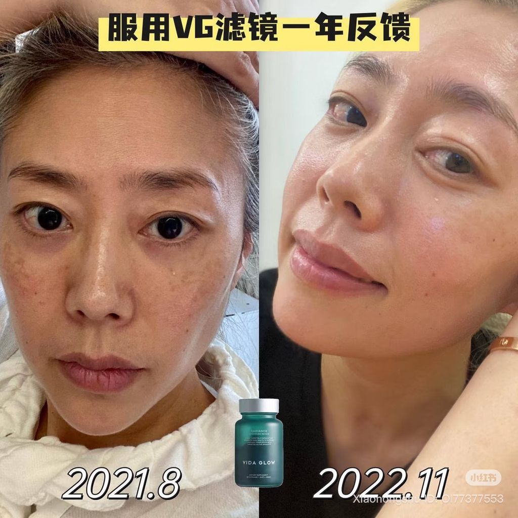 image_22F88606-BD65-4EDB-B9C6-FC4B46D82B41_1754559071