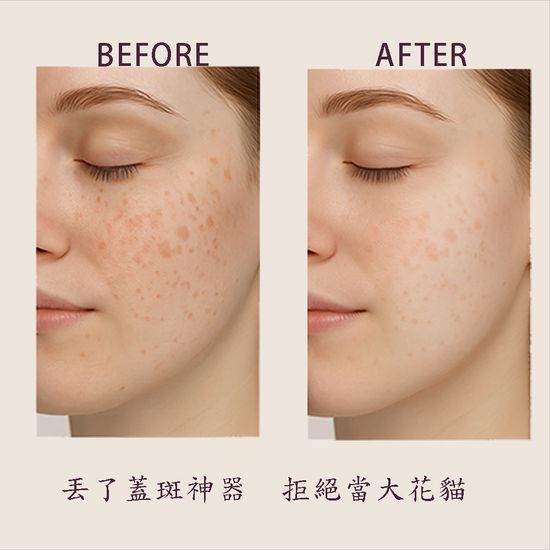告別黃黑皮 | JINKO